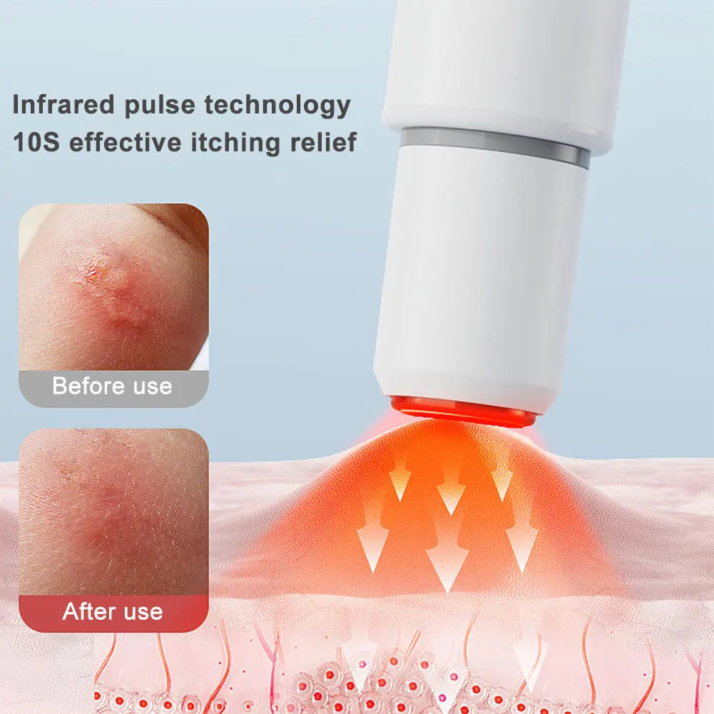Soulageur Thermique Anti-Piqûres